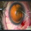 STELLA-OPH-MICROSCOPE-FLOOR-MOUNT,optinovate,optinovate-technologies,optical,optician,optometry,eyeclinic-equipment